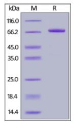 Human IL-12B, Fc Tag on SDS-PAGE under reducing (R) condition. The gel was stained overnight with Coomassie Blue. The purity of the protein is greater than 95%.